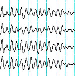 Raw EEG waves