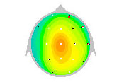 QEEG map